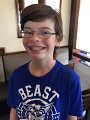 Alex_Braces_2017 (3)